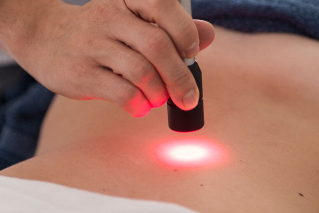 laser_terapia